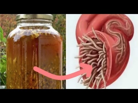 Halamang-singaw kuko sa paa paggamot kakanyahan Ipakita ang mga larawan ng kuko halamang-singaw