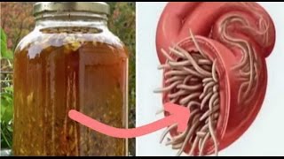 Cure All Infections And Kill All Parasites With This DIY Antibiotic