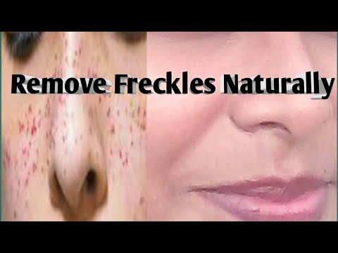 How To Get Rid Of Freckles On Face Naturally In Hindi...