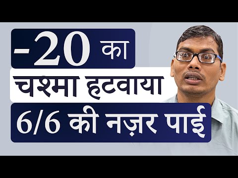 -20 चश्मे का नंबर RLE से हटवाया ।  RLE surgery for Specs Removal - If Not Eligible for LASIK or ICL