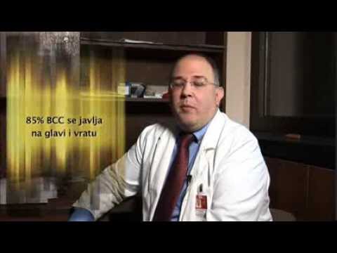 Uzroci i faktori rizika za nastanak bezocelularnog karcinoma