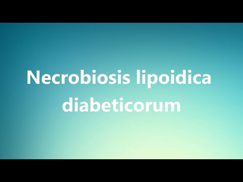 Diabetes mellitus glycemic control and risk of atrial fibrillation