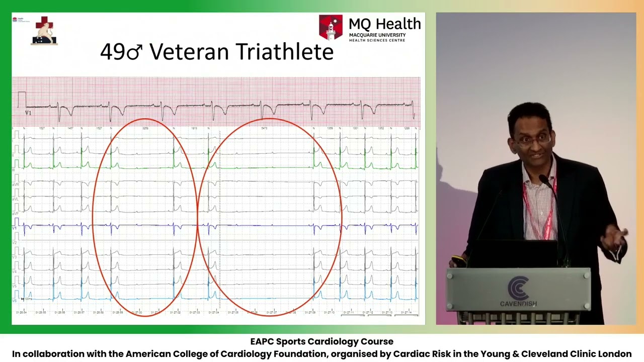 Pauses and heart blocks; When is slow too slow - H  Raju
