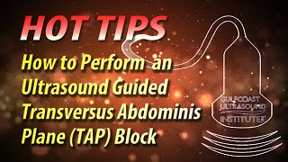 How to Perform an Ultrasound Guided Transversus Abdominis Plane (TAP) Block