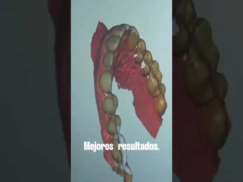 video itk40MXw9Sc