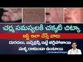 How to Get Relief from Itching | Parasitic Infection | Albendazole Tablets | Dr.Ravikanth Kongara