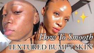 How to Get Rid & Smoothen TEXTURED , BUMPY Skin | #dryskin #acneproneskin  #skincareroutine