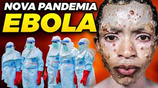 SURTO DE EBOLA: OMS FAZ ALARME DE  POSSÍVEL PANDEMIA