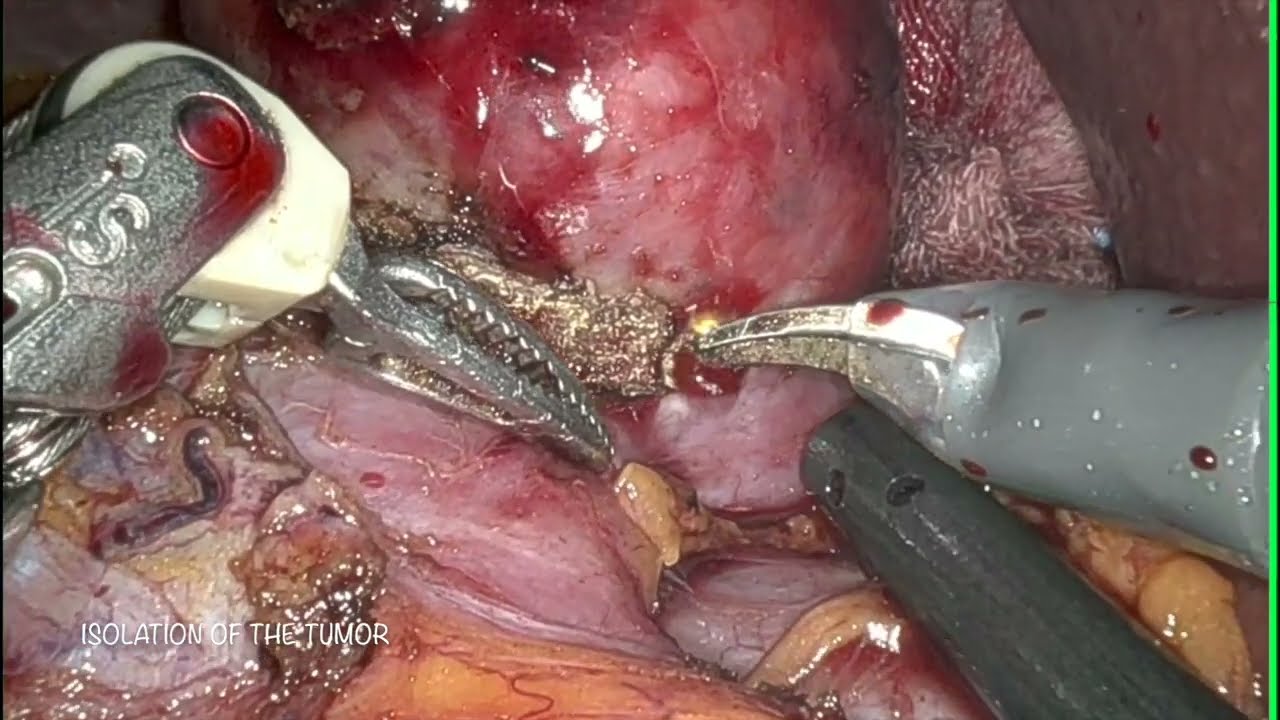 Antonio Martinelli-5