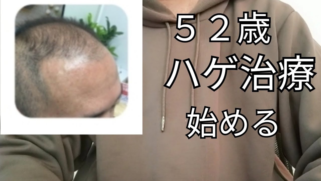 52歳｢ＡＧＡ治療｣始める理由