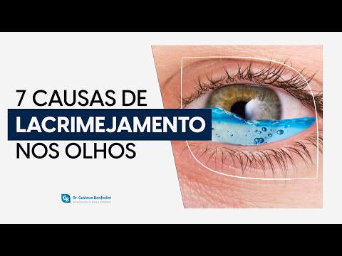 Watery eyes - what causes this condition? - Dr. Gustavo Bonfadini