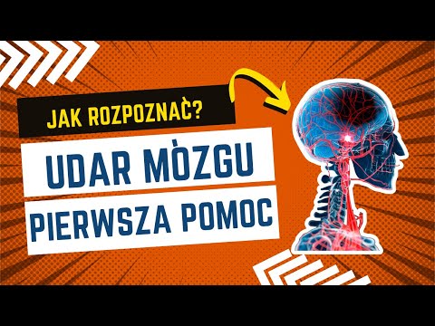 Udar mózgu- pierwsza pomoc🚨 #udar