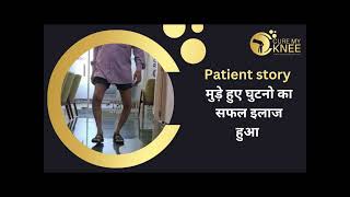 Knee Replacement Surgery Delhi | Dr. D K Das @CureMyKnee #bowlegs #kneereplacementsurgeon ​⁠