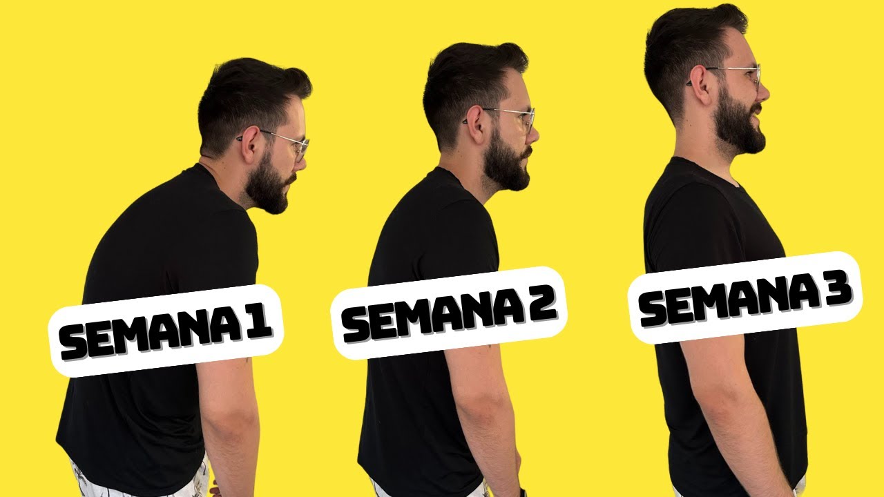 How to improve posture! 4 best solutions