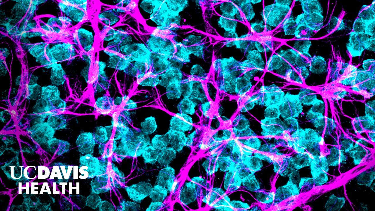 Thumbnail preview of Explorando soluciones de células madre para la ceguera por glaucoma