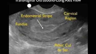 How To: Ectopic Pregnancy - Part 1 Case Study Video