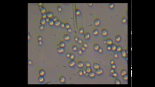 Cellule al microscopio: Lievito di birra (Saccharomyces Cerevisiae)