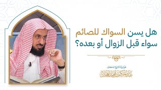 هل يسن السواك للصائم سواء قبل الزوال أو بعده؟ image