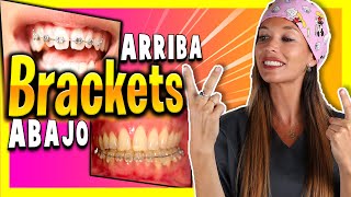 🤔¿Se puede poner 𝑩𝑹𝑨𝑪𝑲𝑬𝑻𝑺 𝒔𝒐𝒍𝒐 𝑨𝑩𝑨𝑱𝑶 𝒐 𝒔𝒐𝒍𝒐 𝑨𝑹𝑹𝑰𝑩𝑨 Te lo explico F̲A̲C̲I̲L̲ ̲Y̲ ̲R̲A̲P̲I̲D̲O̲ ✅