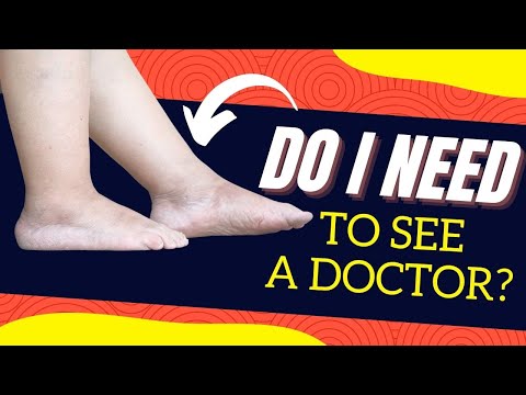 8 Common Causes of Swollen Ankles, Is a Dr. Visit NEEDED?
