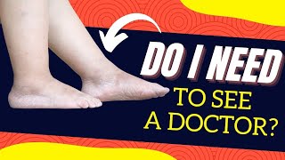 8 Common Causes of Swollen Ankles, Is a Dr. Visit NEEDED?