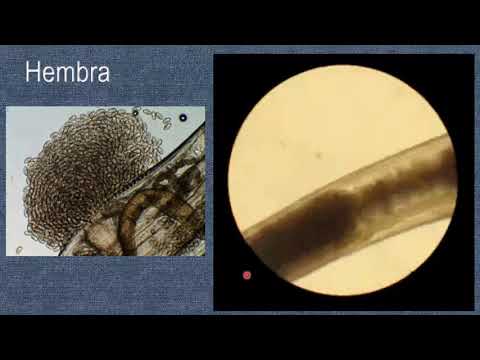 Papilloma virus come lo contrae l uomo