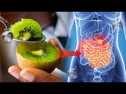 Ja çfarë ndodh në trupin tuaj nëse hani 3 kivi në ditë për 1 javë