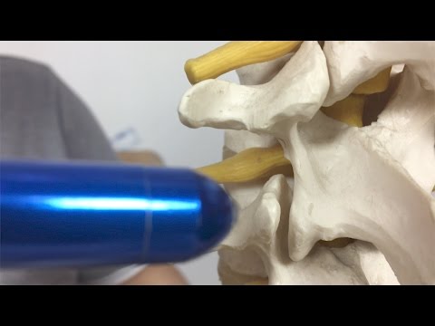 Trattamento osteofiti moda di rimedi popolari Rigidità delle articolazioni al mattino i piedi