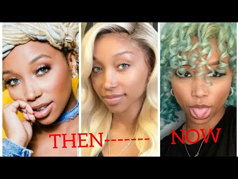 Zonnique Eye Implants Causing Her to Go Blind, had several surgeries to get them Removed