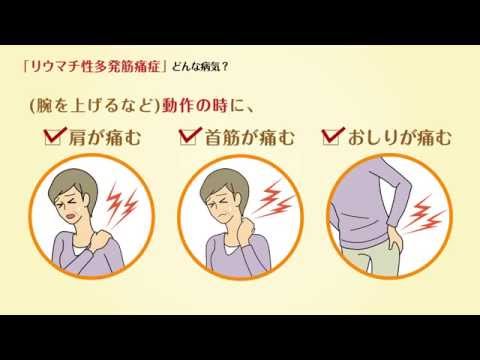 リウマチ性多発筋痛症