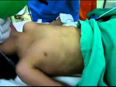 image-What does Unlabored breathing mean?