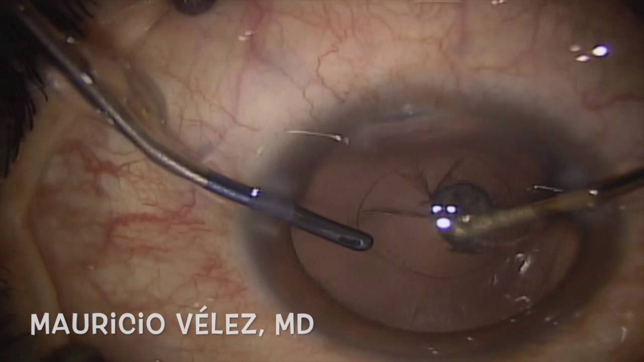 Mauricio Velez Fernandez-22