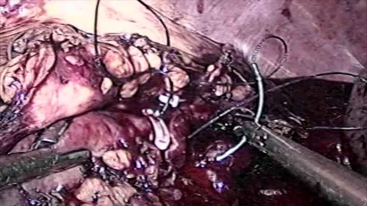 Josias Rodrigues Westphal-9