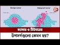 ক্যান্সার ও টিউমারের উপসর্গগুলো কেমন