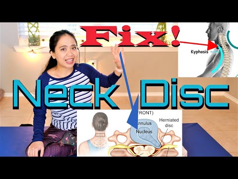 C6-C7 Herniated Disc Neck Pain and Weakness Exercises Relief