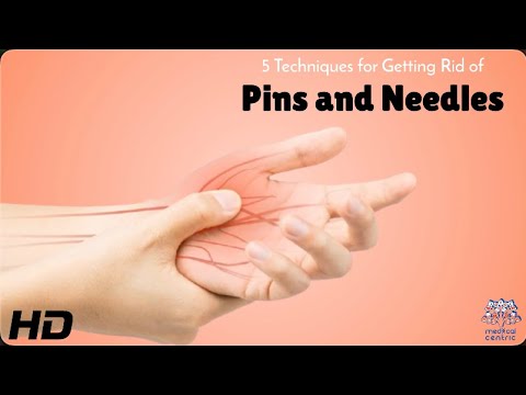 Tingling Sensation? Try These Tricks to Stop Pins and Needles Instantly 🤚