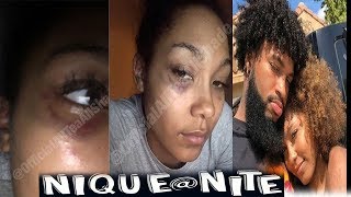 Did Chris Sails admit to Putting hands on Parker