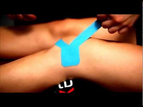 Trattamento ginocchio deformato Zampe posteriori mal di cosa fare