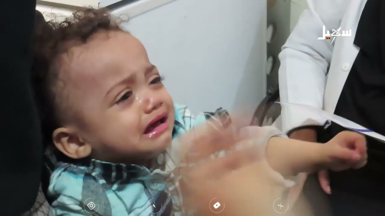 طوارئ صحية بعد تفش مباغت للحصبة