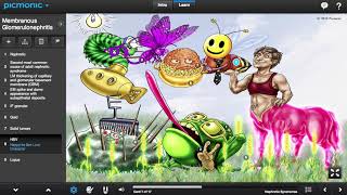 Membranous Glomerulonephritis