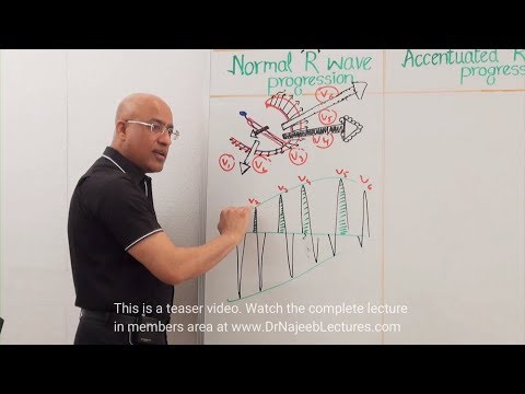 ECG - EKG Chest Leads Abnormalities of R wave progression 🫀