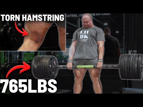 Deadlifting With A Torn Hamstring | Road To Rogue Begins