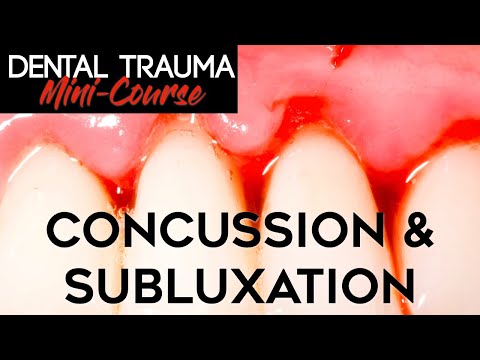 Dental Trauma Mini-Course - Part 7 - Dental Trauma Guide - Concussion & Subluxation Injuries