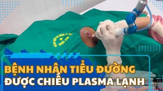 PlasmaMED: Điều trị cho bệnh nhân có vết loét – biến chứng tiểu đường