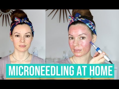 How I Microneedle at Home with Dr. Pen - Demo & Tips