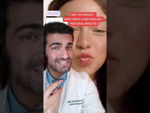 Whiter Teeth + Rinsing with Hydrogen Peroxide!? #shorts