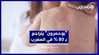 التهراوي: المغرب يسجل تراجعًا بنسبة 80% في حالات الحصبة بفضل حملة التلقيح thumbnail