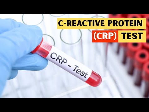 C-Reactive Protein (CRP) Test - Everything You Need To Know