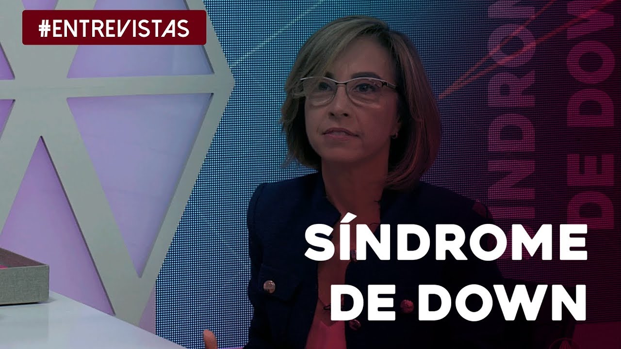 Tudo o que você precisa saber sobre síndrome de Down