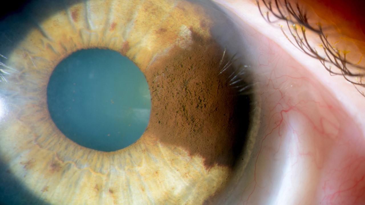 Supporting Eye Health With Innovative Imaging video